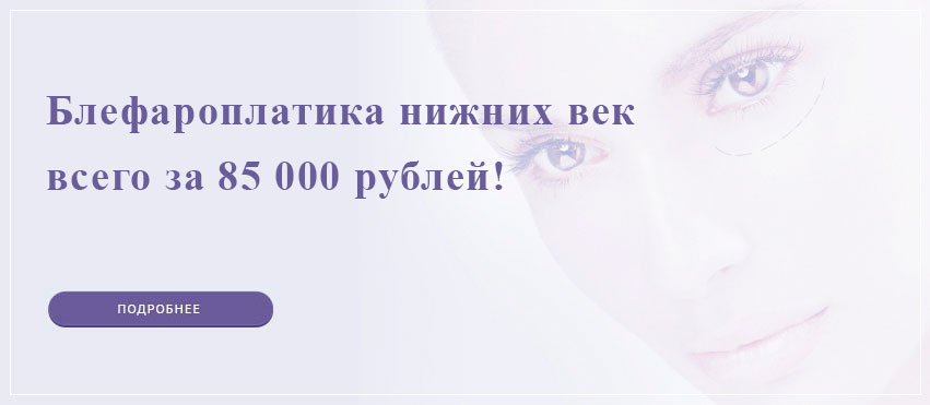 Скидка на блефаропластику нижних век в Подольске