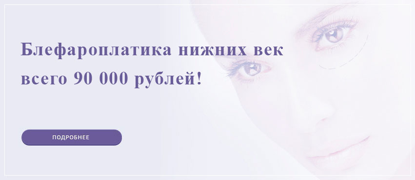Скидка на блефаропластику нижних век в Подольске
